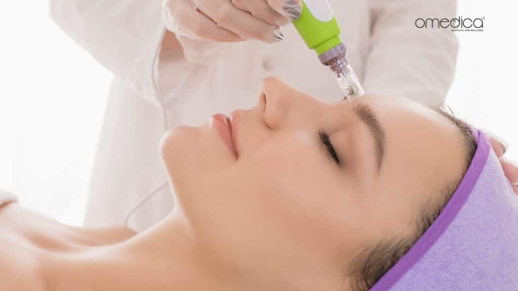 Perbandingan Dermapen Featured Image